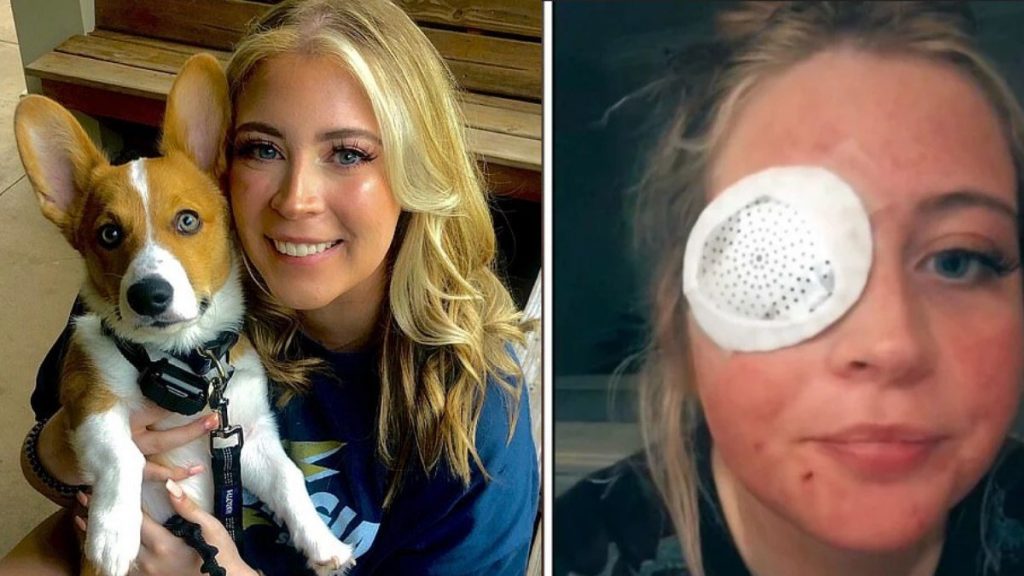 Dog removes woman’s eyelid after attack in US;  Pictures are powerful |  Unusual world