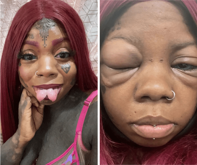 The Jamaican wears body modifications, such as slits and tattoos, and shares her health status through TikTok